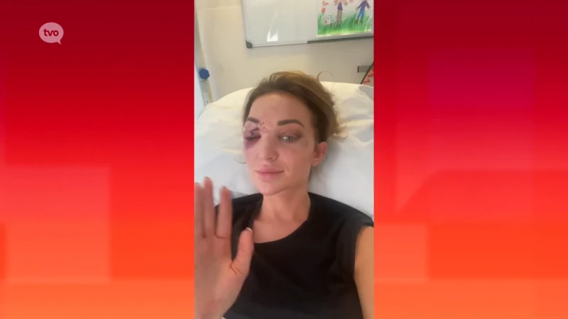 Miss België Chayenne Van Aarle terug thuis en aan beterhand na horrorcrash